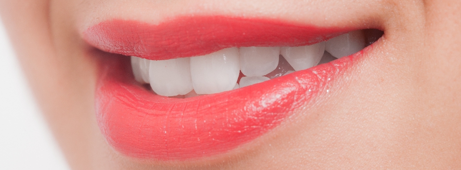 ホワイトニング